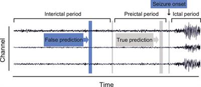 Seizure Prediction With HIVE-CODAs: The Hierarchical Vote Collective of Domain Adaptation Methods